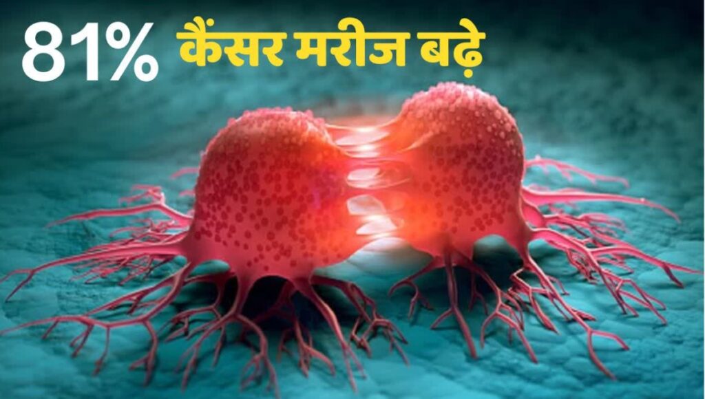 PMCH